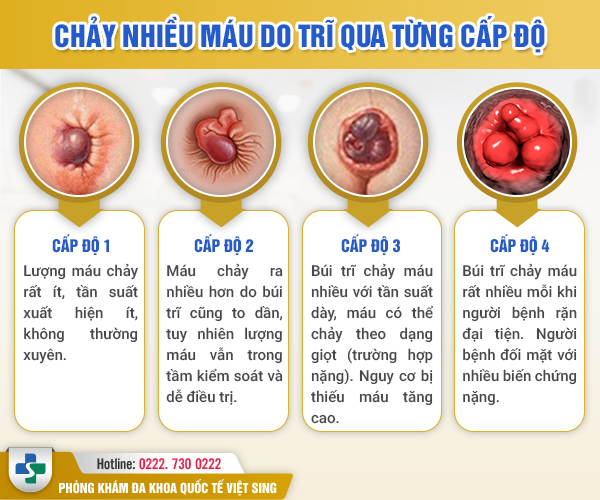 https://benhtribacninh.com/wp-content/uploads/2023/05/chay-mau-tri-qua-cap-do.jpg