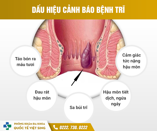 https://benhtribacninh.com/wp-content/uploads/2023/05/dauhieutri.jpg