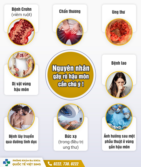 https://benhtribacninh.com/wp-content/uploads/2023/05/nguyen-nhan-bi-ro-hau-mon.jpg