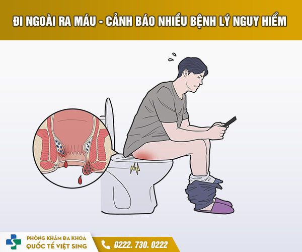 https://benhtribacninh.com/wp-content/uploads/2023/06/Tri-1.jpg