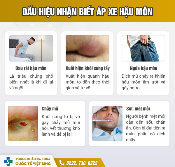 https://benhtribacninh.com/wp-content/uploads/2023/06/dau-hieu-nhan-biet-ap-xe-hau-mon.jpg