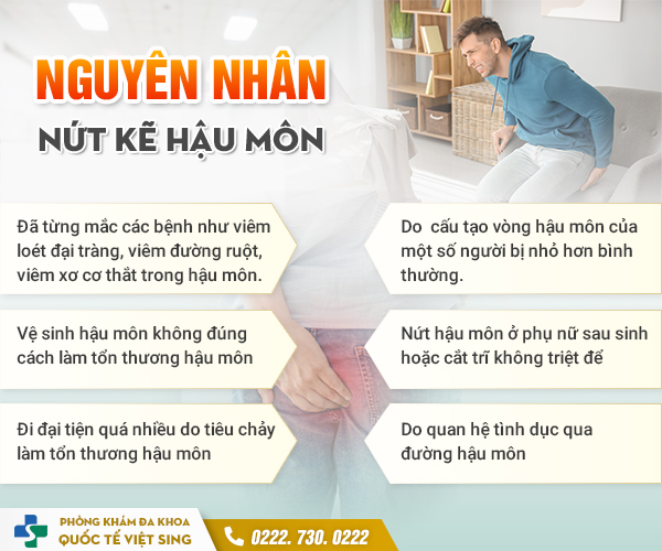 https://benhtribacninh.com/wp-content/uploads/2023/06/nguyen-nhan-nut-ke-hau-mon.jpg