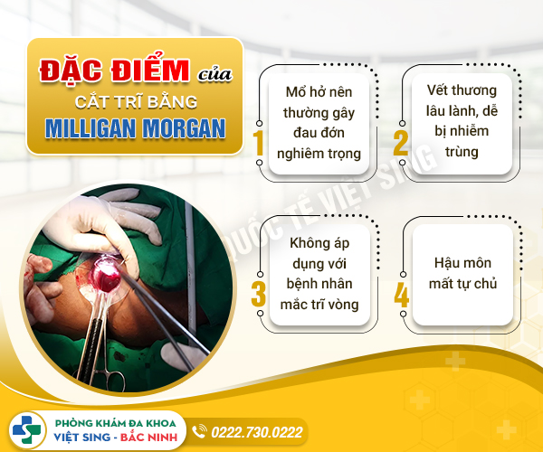 Cắt trĩ phương pháp Millian morgan có hiệu quả ko? Đâu là phương pháp tốt nhất hiện nay
