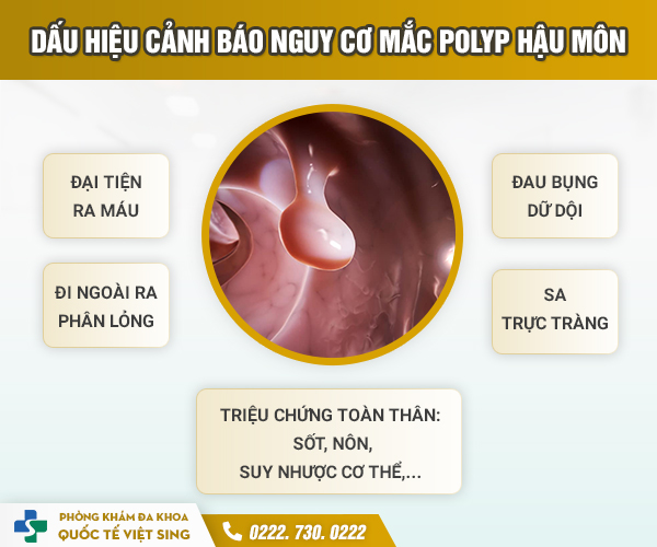 Chuyên gia chia sẻ toàn bộ thông tin cần biết về polyp hậu môn từ A-Z