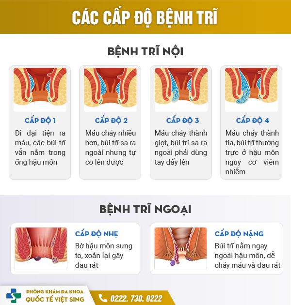 Hành Trình Chữa Trĩ Online Gặp Lang Băm Và Cái Kết