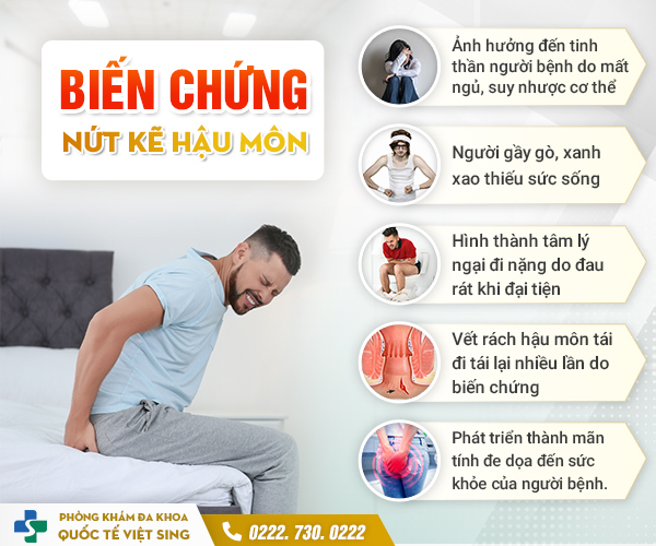 Những hiểu sai khi chữa nứt kẽ hậu môn & cách chữa hiệu quả từ chuyên gia