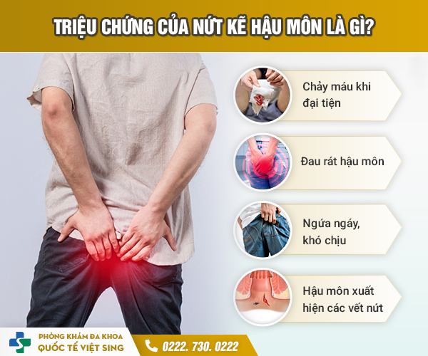 Nứt kẽ hậu môn – Căn bệnh thầm lặng dễ bị bỏ qua