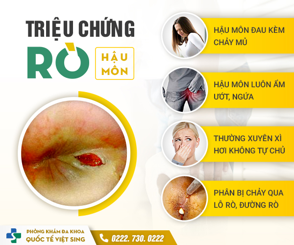 Tổng hợp những điều cần biết về rò hậu môn – Lắng nghe chuyên gia chia sẻ